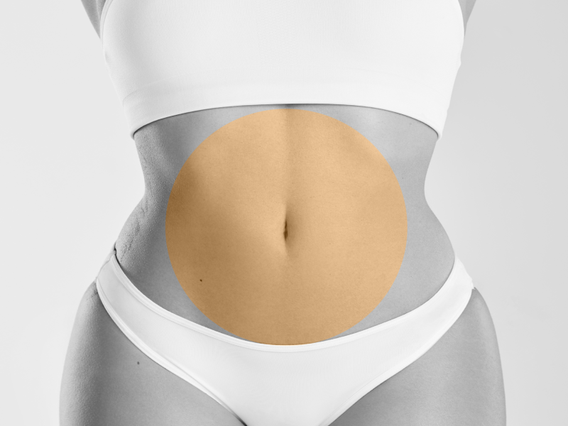 Abdominoplastia - Beneficii estetice și funcționale