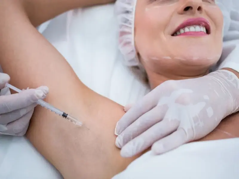 Tratamentul Hiperhidrozei cu Toxină Botulinică